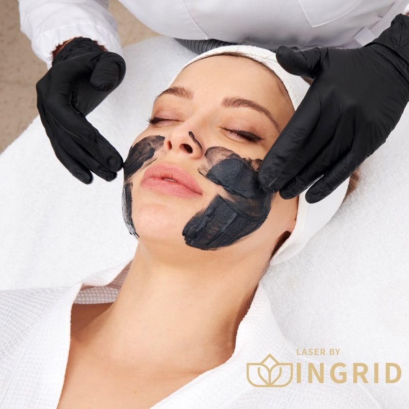 Laser Carbon Facial